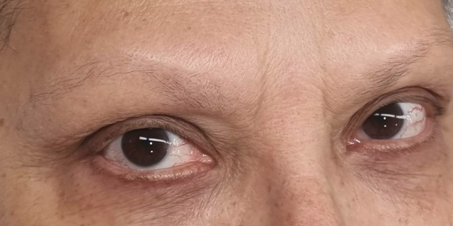 Cejas antes del microblading